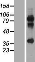 Western blot validation of overexpression lysate (Cat# LY407012) using anti-DDK antibody (Cat# TA50011-100). Left: Cell lysates from un-transfected HEK293T cells; Right: Cell lysates from HEK293T cells transfected with RC215355 using transfection reagent MegaTran 2.0 (Cat# TT210002).