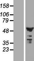 Western blot validation of overexpression lysate (Cat# LY413693) using anti-DDK antibody (Cat# TA50011-100). Left: Cell lysates from un-transfected HEK293T cells; Right: Cell lysates from HEK293T cells transfected with RC209407 using transfection reagent MegaTran 2.0 (Cat# TT210002).