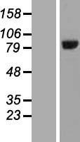 Western blot validation of overexpression lysate (Cat# LY410151) using anti-DDK antibody (Cat# TA50011-100). Left: Cell lysates from un-transfected HEK293T cells; Right: Cell lysates from HEK293T cells transfected with RC208912 using transfection reagent MegaTran 2.0 (Cat# TT210002).