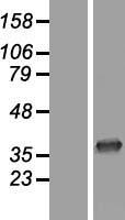 Western blot validation of overexpression lysate (Cat# LY415657) using anti-DDK antibody (Cat# TA50011-100). Left: Cell lysates from un-transfected HEK293T cells; Right: Cell lysates from HEK293T cells transfected with RC209293 using transfection reagent MegaTran 2.0 (Cat# TT210002).