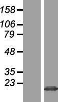 Western blot validation of overexpression lysate (Cat# LY410920) using anti-DDK antibody (Cat# TA50011-100). Left: Cell lysates from un-transfected HEK293T cells; Right: Cell lysates from HEK293T cells transfected with RC209713 using transfection reagent MegaTran 2.0 (Cat# TT210002).