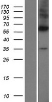 Western blot validation of overexpression lysate (Cat# LY404394) using anti-DDK antibody (Cat# TA50011-100). Left: Cell lysates from un-transfected HEK293T cells; Right: Cell lysates from HEK293T cells transfected with RC208407 using transfection reagent MegaTran 2.0 (Cat# TT210002).
