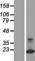 Western blot validation of overexpression lysate (Cat# LY407603) using anti-DDK antibody (Cat# TA50011-100). Left: Cell lysates from un-transfected HEK293T cells; Right: Cell lysates from HEK293T cells transfected with RC206308 using transfection reagent MegaTran 2.0 (Cat# TT210002).