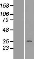 Western blot validation of overexpression lysate (Cat# LY408830) using anti-DDK antibody (Cat# TA50011-100). Left: Cell lysates from un-transfected HEK293T cells; Right: Cell lysates from HEK293T cells transfected with RC206303 using transfection reagent MegaTran 2.0 (Cat# TT210002).
