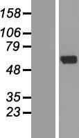 Western blot validation of overexpression lysate (Cat# LY404258) using anti-DDK antibody (Cat# TA50011-100). Left: Cell lysates from un-transfected HEK293T cells; Right: Cell lysates from HEK293T cells transfected with RC224846 using transfection reagent MegaTran 2.0 (Cat# TT210002).