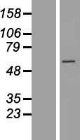 Western blot validation of overexpression lysate (Cat# LY416545) using anti-DDK antibody (Cat# TA50011-100). Left: Cell lysates from un-transfected HEK293T cells; Right: Cell lysates from HEK293T cells transfected with RC205267 using transfection reagent MegaTran 2.0 (Cat# TT210002).
