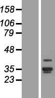 Western blot validation of overexpression lysate (Cat# LY406585) using anti-DDK antibody (Cat# TA50011-100). Left: Cell lysates from un-transfected HEK293T cells; Right: Cell lysates from HEK293T cells transfected with RC206195 using transfection reagent MegaTran 2.0 (Cat# TT210002).