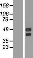 Western blot validation of overexpression lysate (Cat# LY407116) using anti-DDK antibody (Cat# TA50011-100). Left: Cell lysates from un-transfected HEK293T cells; Right: Cell lysates from HEK293T cells transfected with RC206185 using transfection reagent MegaTran 2.0 (Cat# TT210002).