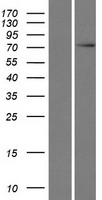 Western blot validation of overexpression lysate (Cat# LY422008) using anti-DDK antibody (Cat# TA50011-100). Left: Cell lysates from un-transfected HEK293T cells; Right: Cell lysates from HEK293T cells transfected with RC206213 using transfection reagent MegaTran 2.0 (Cat# TT210002).