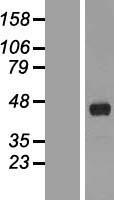 Western blot validation of overexpression lysate (Cat# LY407972) using anti-DDK antibody (Cat# TA50011-100). Left: Cell lysates from un-transfected HEK293T cells; Right: Cell lysates from HEK293T cells transfected with RC205465 using transfection reagent MegaTran 2.0 (Cat# TT210002).