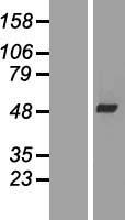 Western blot validation of overexpression lysate (Cat# LY405839) using anti-DDK antibody (Cat# TA50011-100). Left: Cell lysates from un-transfected HEK293T cells; Right: Cell lysates from HEK293T cells transfected with RC205460 using transfection reagent MegaTran 2.0 (Cat# TT210002).