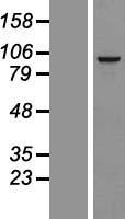 Western blot validation of overexpression lysate (Cat# LY406476) using anti-DDK antibody (Cat# TA50011-100). Left: Cell lysates from un-transfected HEK293T cells; Right: Cell lysates from HEK293T cells transfected with RC220976 using transfection reagent MegaTran 2.0 (Cat# TT210002).