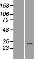 Western blot validation of overexpression lysate (Cat# LY407418) using anti-DDK antibody (Cat# TA50011-100). Left: Cell lysates from un-transfected HEK293T cells; Right: Cell lysates from HEK293T cells transfected with RC205495 using transfection reagent MegaTran 2.0 (Cat# TT210002).