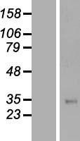 Western blot validation of overexpression lysate (Cat# LY422293) using anti-DDK antibody (Cat# TA50011-100). Left: Cell lysates from un-transfected HEK293T cells; Right: Cell lysates from HEK293T cells transfected with RC202098 using transfection reagent MegaTran 2.0 (Cat# TT210002).