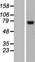 Western blot validation of overexpression lysate (Cat# LY413541) using anti-DDK antibody (Cat# TA50011-100). Left: Cell lysates from un-transfected HEK293T cells; Right: Cell lysates from HEK293T cells transfected with RC203697 using transfection reagent MegaTran 2.0 (Cat# TT210002).