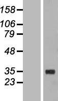Western blot validation of overexpression lysate (Cat# LY411006) using anti-DDK antibody (Cat# TA50011-100). Left: Cell lysates from un-transfected HEK293T cells; Right: Cell lysates from HEK293T cells transfected with RC202158 using transfection reagent MegaTran 2.0 (Cat# TT210002).