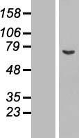 Western blot validation of overexpression lysate (Cat# LY412787) using anti-DDK antibody (Cat# TA50011-100). Left: Cell lysates from un-transfected HEK293T cells; Right: Cell lysates from HEK293T cells transfected with RC201494 using transfection reagent MegaTran 2.0 (Cat# TT210002).