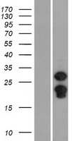 Western blot validation of overexpression lysate (Cat# LY423549) using anti-DDK antibody (Cat# TA50011-100). Left: Cell lysates from un-transfected HEK293T cells; Right: Cell lysates from HEK293T cells transfected with RC213224 using transfection reagent MegaTran 2.0 (Cat# TT210002).