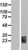 Western blot validation of overexpression lysate (Cat# LY416492) using anti-DDK antibody (Cat# TA50011-100). Left: Cell lysates from un-transfected HEK293T cells; Right: Cell lysates from HEK293T cells transfected with RC210032 using transfection reagent MegaTran 2.0 (Cat# TT210002).