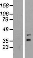 Western blot validation of overexpression lysate (Cat# LY405636) using anti-DDK antibody (Cat# TA50011-100). Left: Cell lysates from un-transfected HEK293T cells; Right: Cell lysates from HEK293T cells transfected with RC207056 using transfection reagent MegaTran 2.0 (Cat# TT210002).