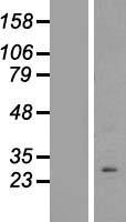 Western blot validation of overexpression lysate (Cat# LY410110) using anti-DDK antibody (Cat# TA50011-100). Left: Cell lysates from un-transfected HEK293T cells; Right: Cell lysates from HEK293T cells transfected with RC210619 using transfection reagent MegaTran 2.0 (Cat# TT210002).