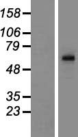 Western blot validation of overexpression lysate (Cat# LY424346) using anti-DDK antibody (Cat# TA50011-100). Left: Cell lysates from un-transfected HEK293T cells; Right: Cell lysates from HEK293T cells transfected with RC224873 using transfection reagent MegaTran 2.0 (Cat# TT210002).