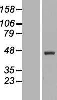 Western blot validation of overexpression lysate (Cat# LY416039) using anti-DDK antibody (Cat# TA50011-100). Left: Cell lysates from un-transfected HEK293T cells; Right: Cell lysates from HEK293T cells transfected with RC210644 using transfection reagent MegaTran 2.0 (Cat# TT210002).
