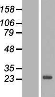 Western blot validation of overexpression lysate (Cat# LY422924) using anti-DDK antibody (Cat# TA50011-100). Left: Cell lysates from un-transfected HEK293T cells; Right: Cell lysates from HEK293T cells transfected with RC209390 using transfection reagent MegaTran 2.0 (Cat# TT210002).