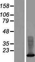 Western blot validation of overexpression lysate (Cat# LY408847) using anti-DDK antibody (Cat# TA50011-100). Left: Cell lysates from un-transfected HEK293T cells; Right: Cell lysates from HEK293T cells transfected with RC214210 using transfection reagent MegaTran 2.0 (Cat# TT210002).