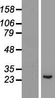 Western blot validation of overexpression lysate (Cat# LY423424) using anti-DDK antibody (Cat# TA50011-100). Left: Cell lysates from un-transfected HEK293T cells; Right: Cell lysates from HEK293T cells transfected with RC205924 using transfection reagent MegaTran 2.0 (Cat# TT210002).