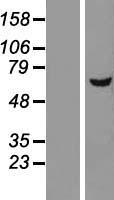 Western blot validation of overexpression lysate (Cat# LY421390) using anti-DDK antibody (Cat# TA50011-100). Left: Cell lysates from un-transfected HEK293T cells; Right: Cell lysates from HEK293T cells transfected with RC205910 using transfection reagent MegaTran 2.0 (Cat# TT210002).