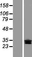 Western blot validation of overexpression lysate (Cat# LY407638) using anti-DDK antibody (Cat# TA50011-100). Left: Cell lysates from un-transfected HEK293T cells; Right: Cell lysates from HEK293T cells transfected with RC205944 using transfection reagent MegaTran 2.0 (Cat# TT210002).