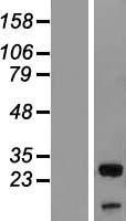 Western blot validation of overexpression lysate (Cat# LY417141) using anti-DDK antibody (Cat# TA50011-100). Left: Cell lysates from un-transfected HEK293T cells; Right: Cell lysates from HEK293T cells transfected with RC204690 using transfection reagent MegaTran 2.0 (Cat# TT210002).