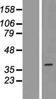 Western blot validation of overexpression lysate (Cat# LY426202) using anti-DDK antibody (Cat# TA50011-100). Left: Cell lysates from un-transfected HEK293T cells; Right: Cell lysates from HEK293T cells transfected with RC225480 using transfection reagent MegaTran 2.0 (Cat# TT210002).