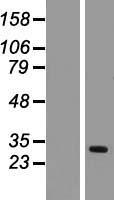 Western blot validation of overexpression lysate (Cat# LY416722) using anti-DDK antibody (Cat# TA50011-100). Left: Cell lysates from un-transfected HEK293T cells; Right: Cell lysates from HEK293T cells transfected with RC205025 using transfection reagent MegaTran 2.0 (Cat# TT210002).