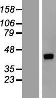 Western blot validation of overexpression lysate (Cat# LY422173) using anti-DDK antibody (Cat# TA50011-100). Left: Cell lysates from un-transfected HEK293T cells; Right: Cell lysates from HEK293T cells transfected with RC204615 using transfection reagent MegaTran 2.0 (Cat# TT210002).