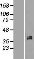 Western blot validation of overexpression lysate (Cat# LY417301) using anti-DDK antibody (Cat# TA50011-100). Left: Cell lysates from un-transfected HEK293T cells; Right: Cell lysates from HEK293T cells transfected with RC208330 using transfection reagent MegaTran 2.0 (Cat# TT210002).