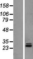 Western blot validation of overexpression lysate (Cat# LY407924) using anti-DDK antibody (Cat# TA50011-100). Left: Cell lysates from un-transfected HEK293T cells; Right: Cell lysates from HEK293T cells transfected with RC208608 using transfection reagent MegaTran 2.0 (Cat# TT210002).