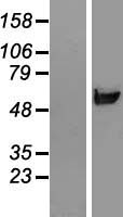 Western blot validation of overexpression lysate (Cat# LY413206) using anti-DDK antibody (Cat# TA50011-100). Left: Cell lysates from un-transfected HEK293T cells; Right: Cell lysates from HEK293T cells transfected with RC210266 using transfection reagent MegaTran 2.0 (Cat# TT210002).