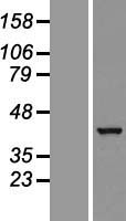 Western blot validation of overexpression lysate (Cat# LY409714) using anti-DDK antibody (Cat# TA50011-100). Left: Cell lysates from un-transfected HEK293T cells; Right: Cell lysates from HEK293T cells transfected with RC210451 using transfection reagent MegaTran 2.0 (Cat# TT210002).