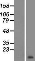 Western blot validation of overexpression lysate (Cat# LY409065) using anti-DDK antibody (Cat# TA50011-100). Left: Cell lysates from un-transfected HEK293T cells; Right: Cell lysates from HEK293T cells transfected with RC210655 using transfection reagent MegaTran 2.0 (Cat# TT210002).