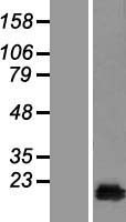 Western blot validation of overexpression lysate (Cat# LY423090) using anti-DDK antibody (Cat# TA50011-100). Left: Cell lysates from un-transfected HEK293T cells; Right: Cell lysates from HEK293T cells transfected with RC210646 using transfection reagent MegaTran 2.0 (Cat# TT210002).