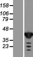 Western blot validation of overexpression lysate (Cat# LY418775) using anti-DDK antibody (Cat# TA50011-100). Left: Cell lysates from un-transfected HEK293T cells; Right: Cell lysates from HEK293T cells transfected with RC210643 using transfection reagent MegaTran 2.0 (Cat# TT210002).