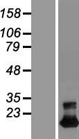 Western blot validation of overexpression lysate (Cat# LY407155) using anti-DDK antibody (Cat# TA50011-100). Left: Cell lysates from un-transfected HEK293T cells; Right: Cell lysates from HEK293T cells transfected with RC209107 using transfection reagent MegaTran 2.0 (Cat# TT210002).