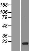 Western blot validation of overexpression lysate (Cat# LY406032) using anti-DDK antibody (Cat# TA50011-100). Left: Cell lysates from un-transfected HEK293T cells; Right: Cell lysates from HEK293T cells transfected with RC209648 using transfection reagent MegaTran 2.0 (Cat# TT210002).