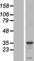 Western blot validation of overexpression lysate (Cat# LY409417) using anti-DDK antibody (Cat# TA50011-100). Left: Cell lysates from un-transfected HEK293T cells; Right: Cell lysates from HEK293T cells transfected with RC209124 using transfection reagent MegaTran 2.0 (Cat# TT210002).
