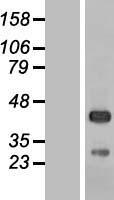 Western blot validation of overexpression lysate (Cat# LY414145) using anti-DDK antibody (Cat# TA50011-100). Left: Cell lysates from un-transfected HEK293T cells; Right: Cell lysates from HEK293T cells transfected with RC209653 using transfection reagent MegaTran 2.0 (Cat# TT210002).