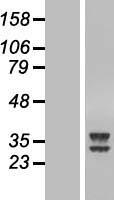 Western blot validation of overexpression lysate (Cat# LY407896) using anti-DDK antibody (Cat# TA50011-100). Left: Cell lysates from un-transfected HEK293T cells; Right: Cell lysates from HEK293T cells transfected with RC202610 using transfection reagent MegaTran 2.0 (Cat# TT210002).
