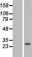 Western blot validation of overexpression lysate (Cat# LY408274) using anti-DDK antibody (Cat# TA50011-100). Left: Cell lysates from un-transfected HEK293T cells; Right: Cell lysates from HEK293T cells transfected with RC201293 using transfection reagent MegaTran 2.0 (Cat# TT210002).