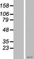 Western blot validation of overexpression lysate (Cat# LY405732) using anti-DDK antibody (Cat# TA50011-100). Left: Cell lysates from un-transfected HEK293T cells; Right: Cell lysates from HEK293T cells transfected with RC220931 using transfection reagent MegaTran 2.0 (Cat# TT210002).